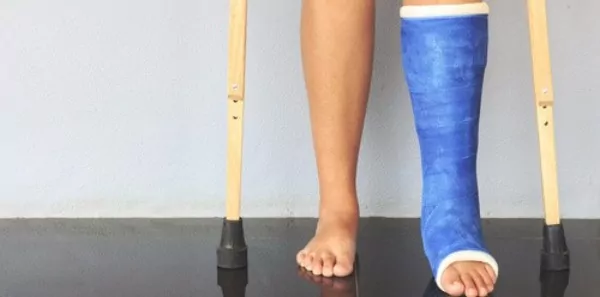 Patient with a blue leg cast and crutches