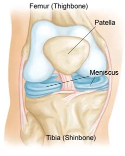 Diagram of the knee. Photo credit: American Academy of Orthopedic Surgeons