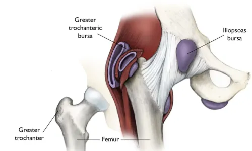 Hip diagram