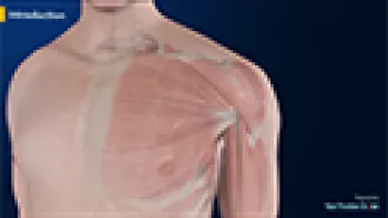Rotator Cuff Tear