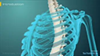 Minimally Invasive Microdiscectomy (METRx Discectomy)