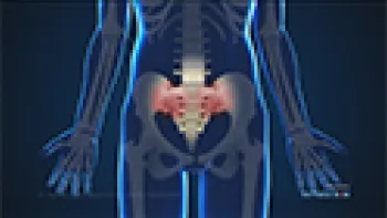 X-ray Guided Sacroiliac Joint Injections (Hip)