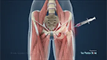 X-ray Guided Hip Injections (Hip)