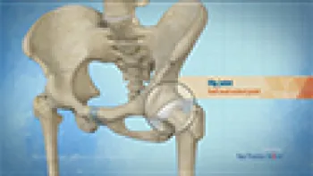 Ultrasound Guided Hip Injections (Hip)