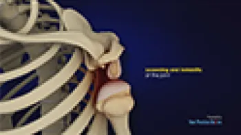Shoulder Instability