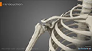 Reverse Total Shoulder Replacement (Joint Replacement)
