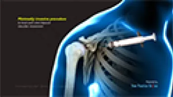 Intraarticular Shoulder Injections