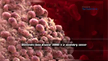 Metastatic Bone Disease