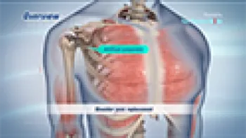 Minimally Invasive Shoulder Joint Replacement (Joint Replacement)