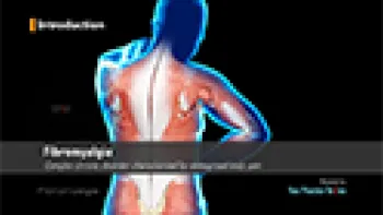 Fibromyalgia