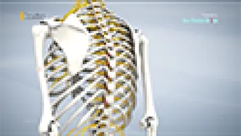 Facet Joint Injection (Spine)