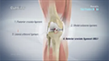 ACL Reconstruction Patellar Tendon