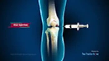 Intra-articular Knee Injections (Knee)