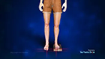 Leg Length Discrepancy (Including use of the PRECICE nail to treat)