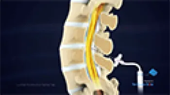 Lumbar Puncture
