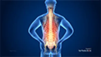 Back Pain