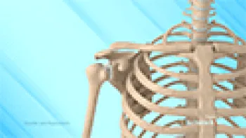 Shoulder Joint Replacement (Shoulder)