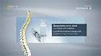 Sympathetic Nerve Block (Pain Management)