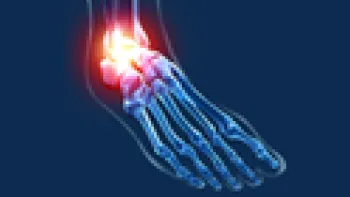 Ankle Sprain