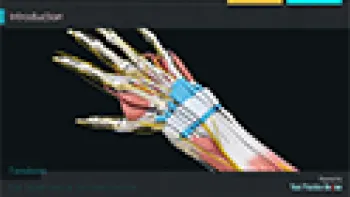 De Quervain's Tenosynovitis