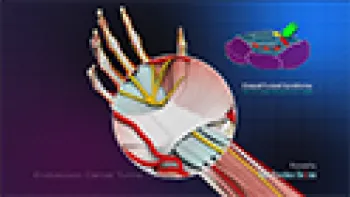 Double Incision Endoscopic Carpal Tunnel Surgery