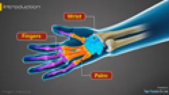 Finger Fractures