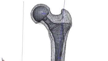 Kinomatic 3D Hip Technology
