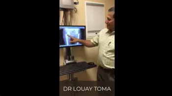 Hip X-Ray