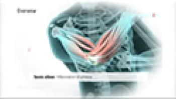 Tennis Elbow