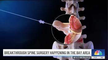 Dr. Hasan Discusses New Endoscopic Treatments for the Spine for Athletes on NBC News