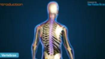 Lateral Lumbar Interbody Fusion