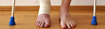Bandaged ankle and crutches