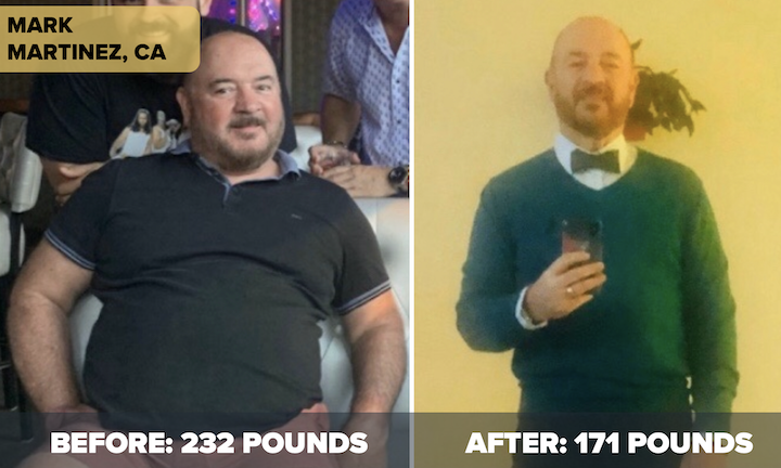 Successful Weight Loss Patient