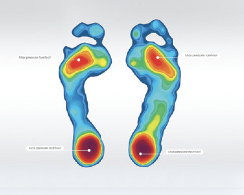 Aetrex Foot Scanner - Golden State Orthopedics & Spine