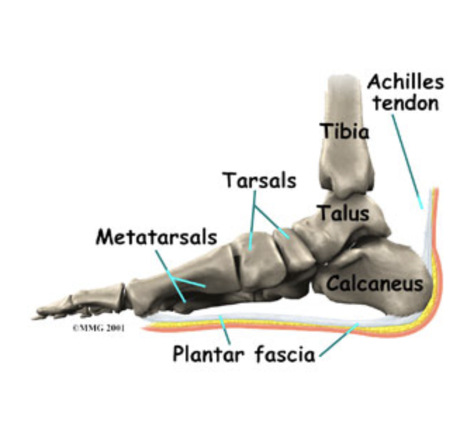 Plantar Fasciitis - Golden State Orthopedics & Spine